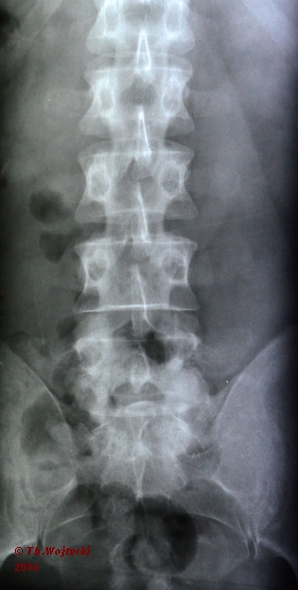 Röntgenbild 3